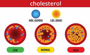 FEATURE ON CHOLESTEROL -  (CLICK BELOW)